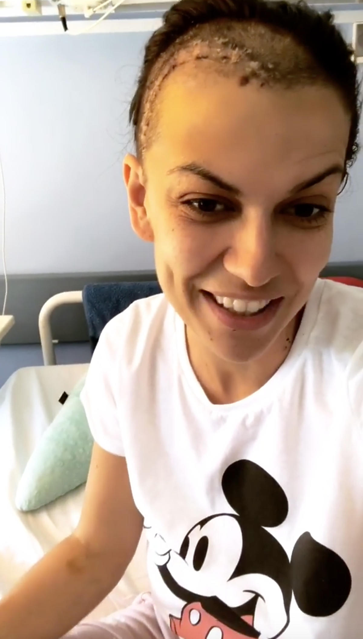 Alżbeta Lenska w szpitalu, pokazała bliznę