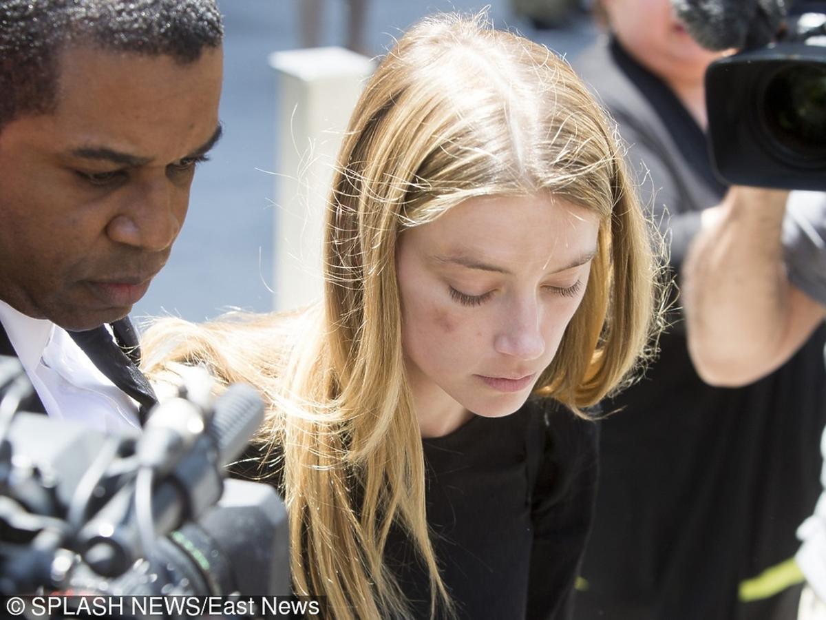 Amber Heard ze śladami pobicia
