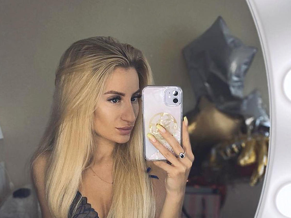 Anna Adamczyk z Hotelu Paradise przed operacją nosa