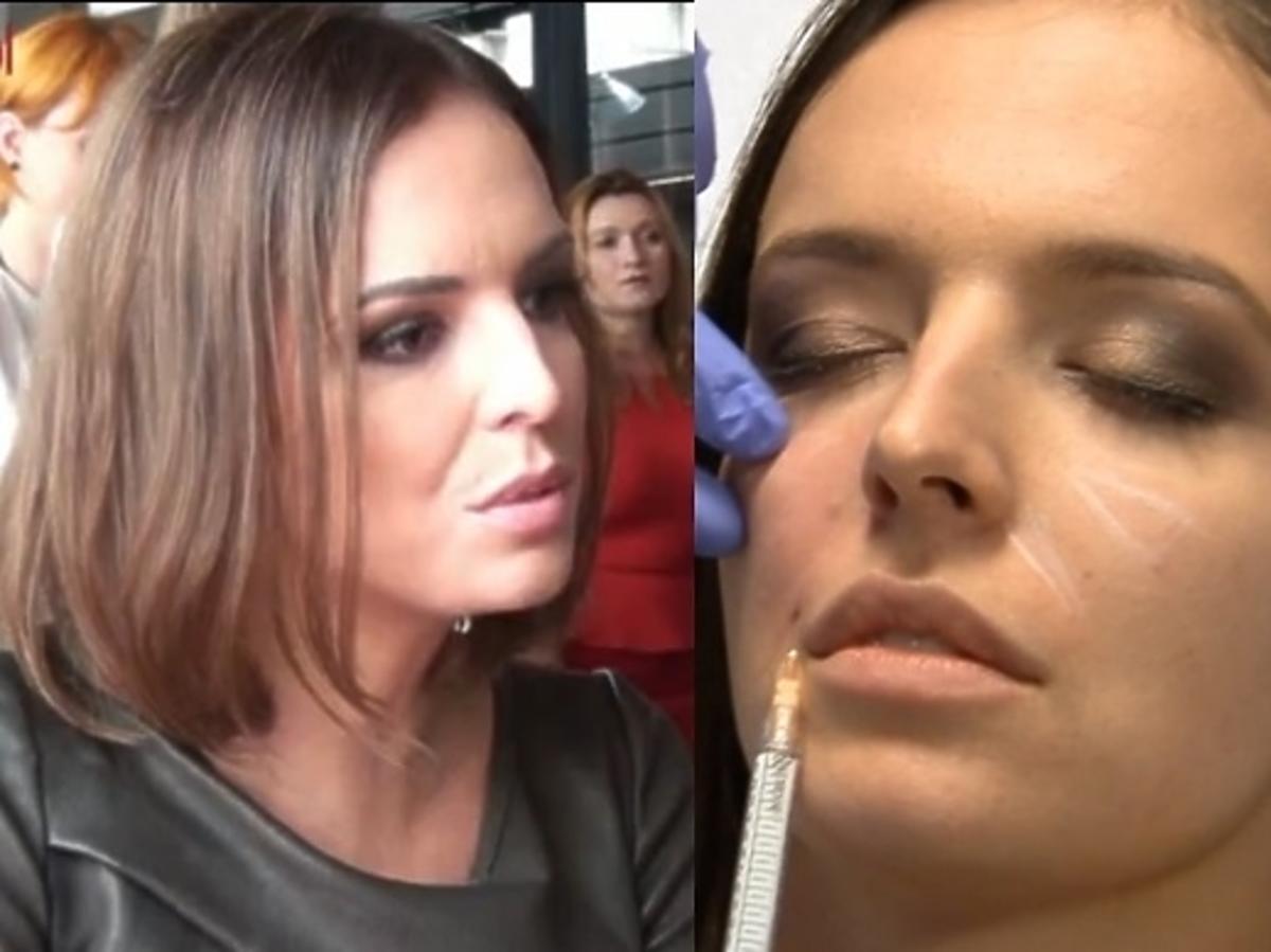 Anna Wendzikowska o medycynie estetycznej