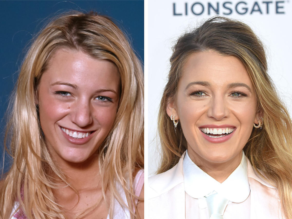 Blake Lively