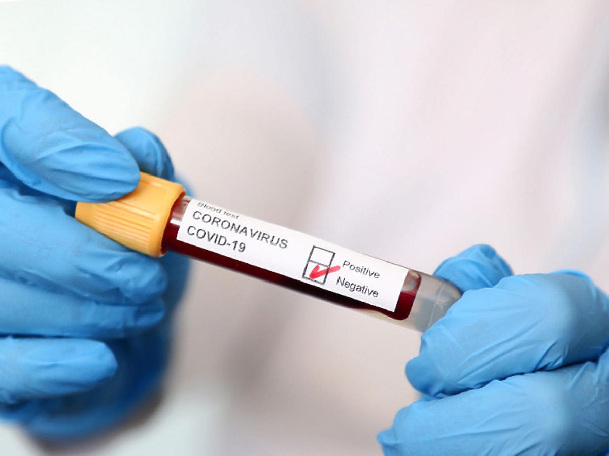 Bosh opracował super szybki test na koronawirusa. Wynik w mniej niż 2,5 godziny