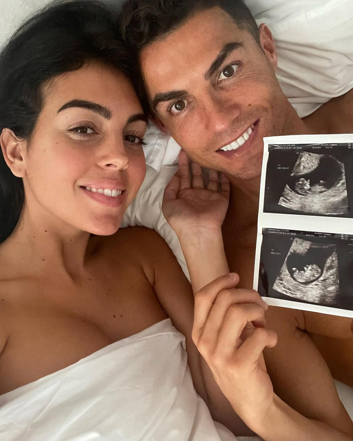 Cristiano Ronaldo zostanie ojcem bliźniaków