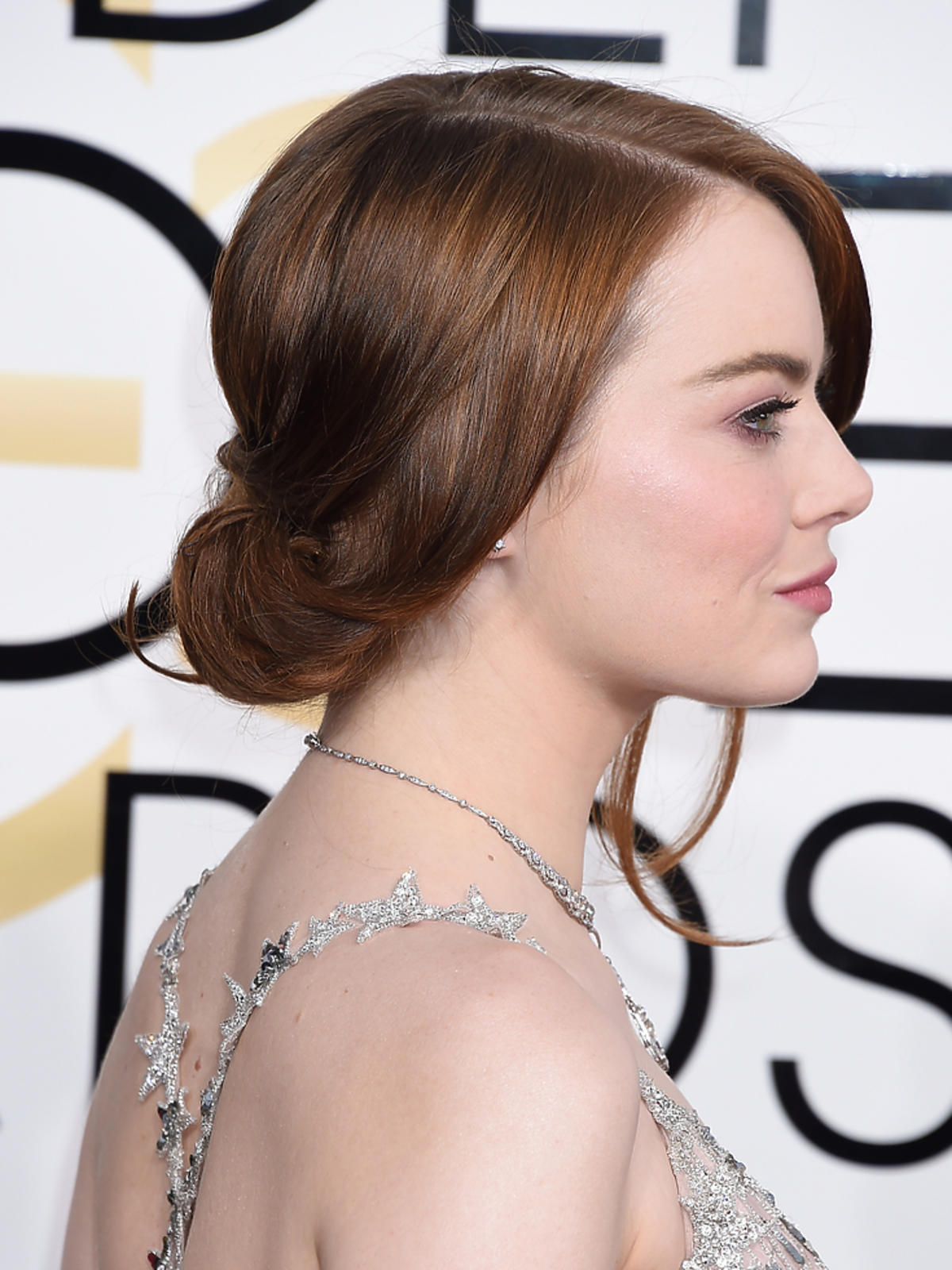 Emma Stone