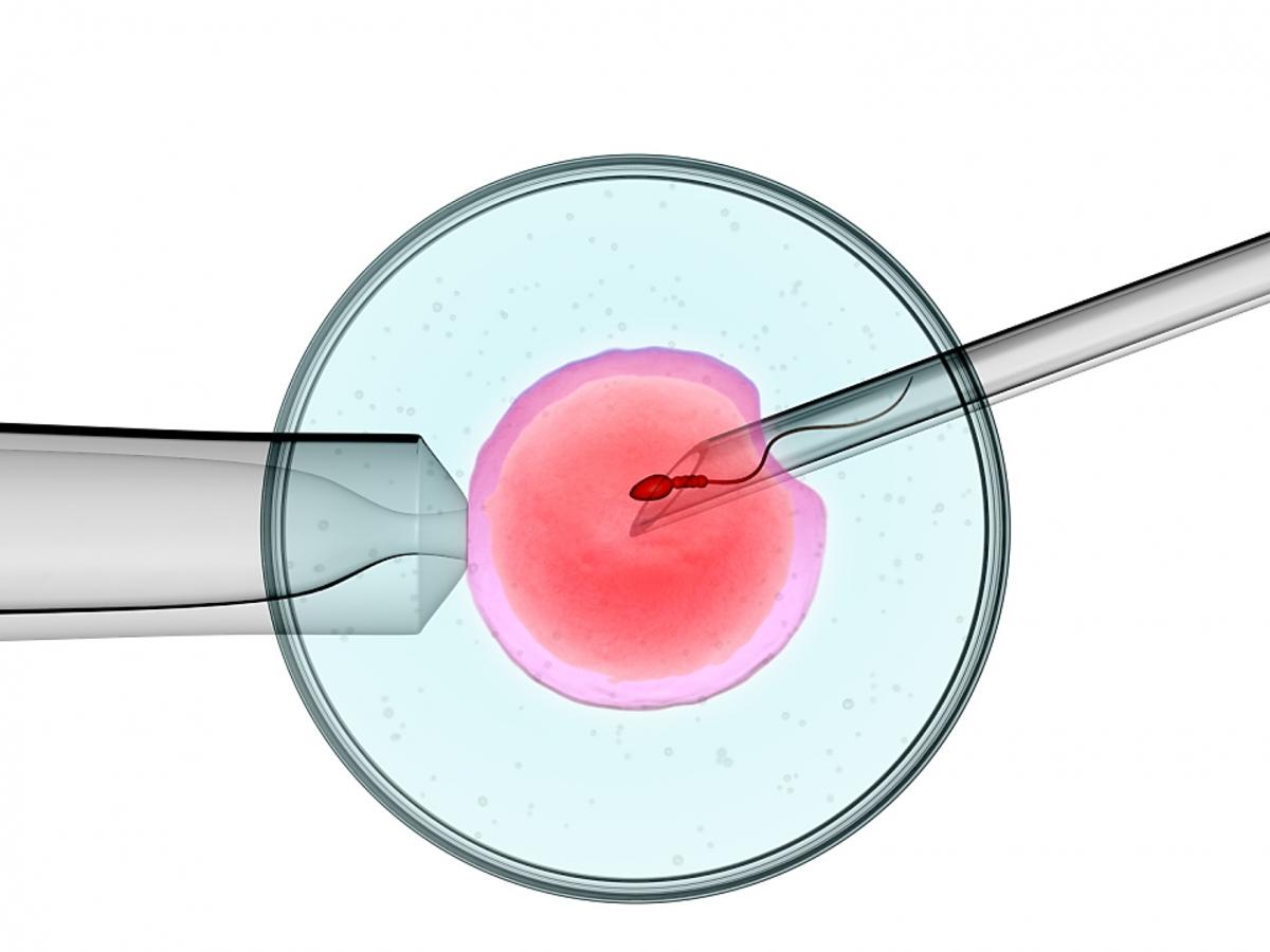 In-Vitro