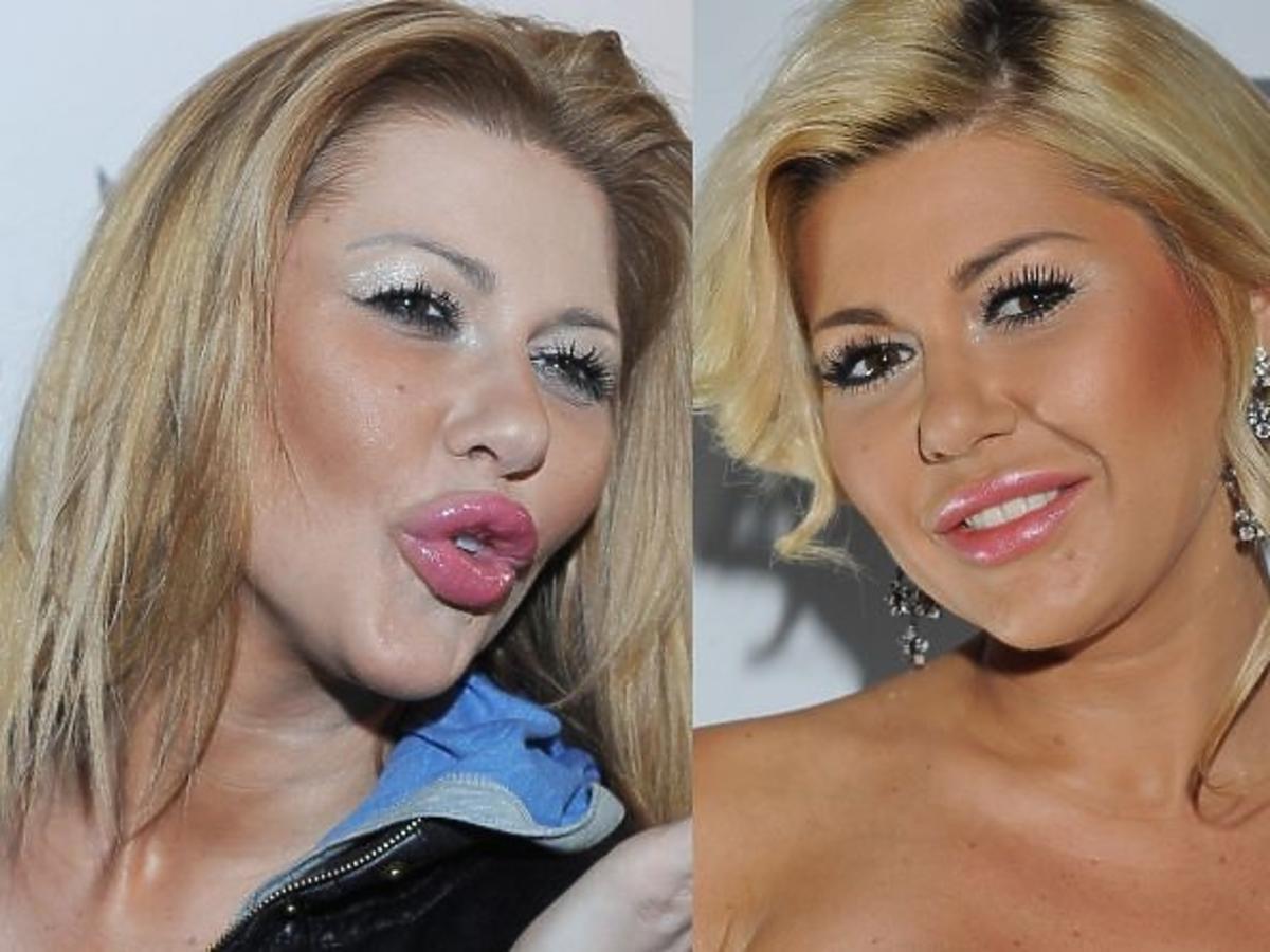 Iwona Węgrowska cieszy się z mniej wydatnych ust