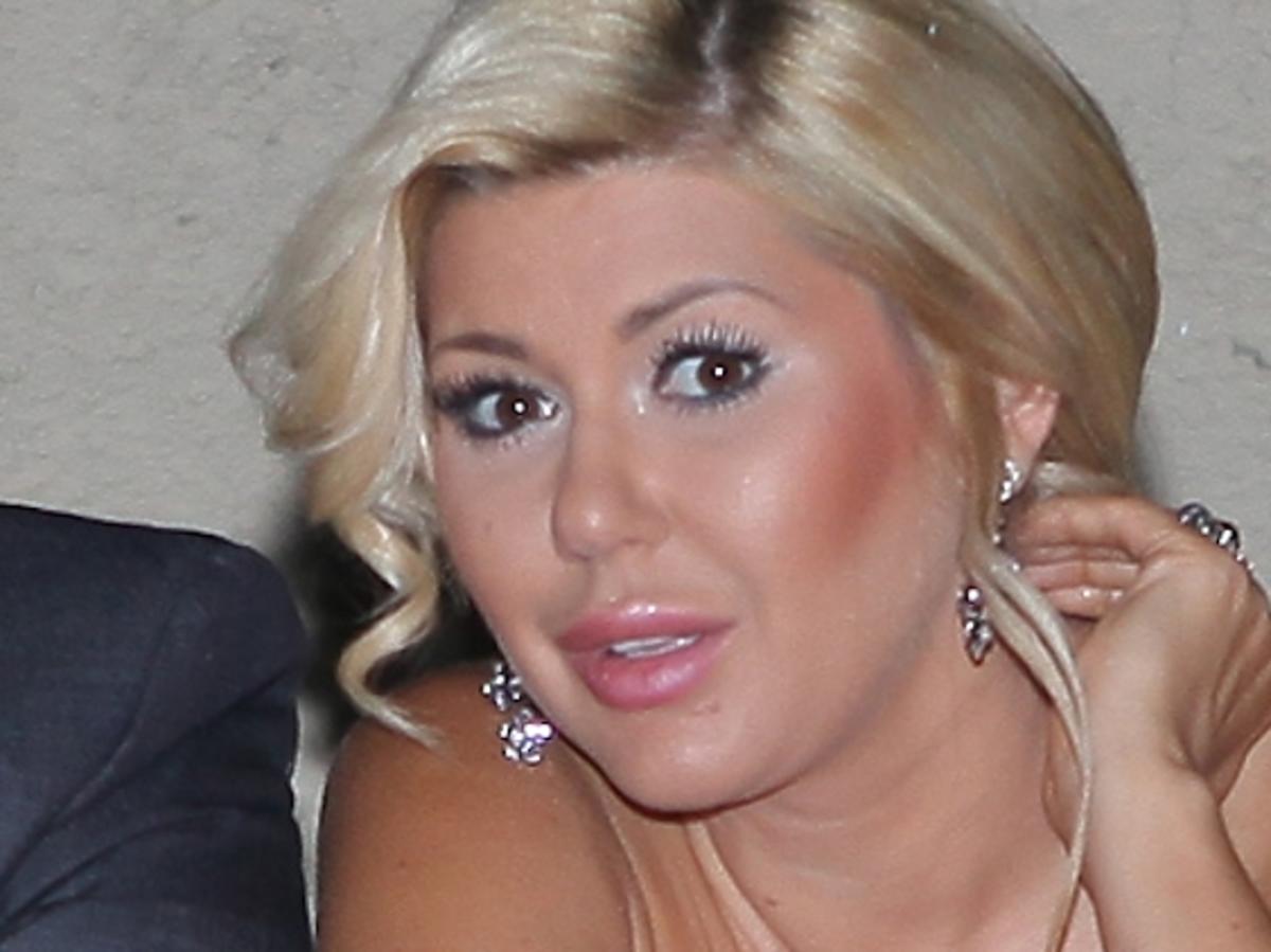 Iwona Węgrowska spaliła sobie piersi słońcem