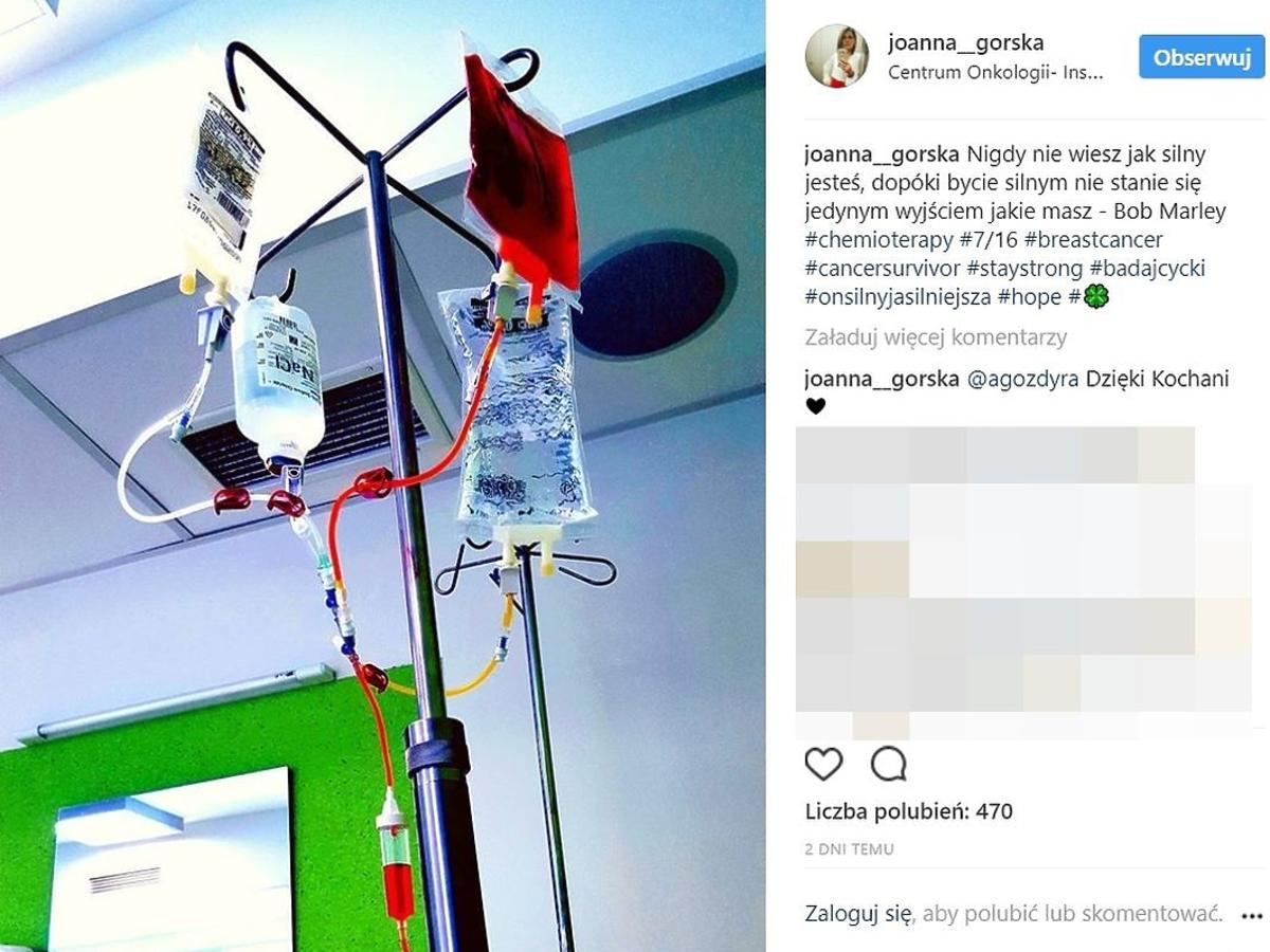 Joanna Górska walczy z rakiem
