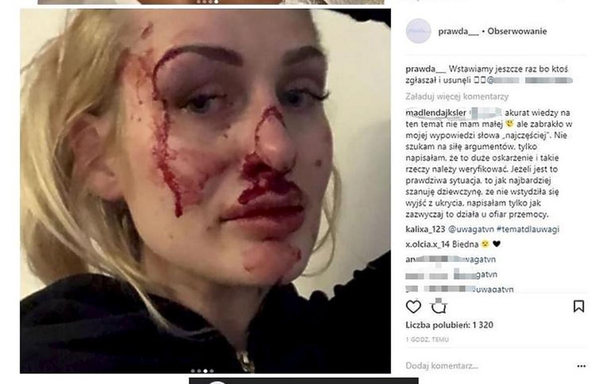 Katarzyna Dziedzic pobita przez swojego chłopaka, trenera personalnego