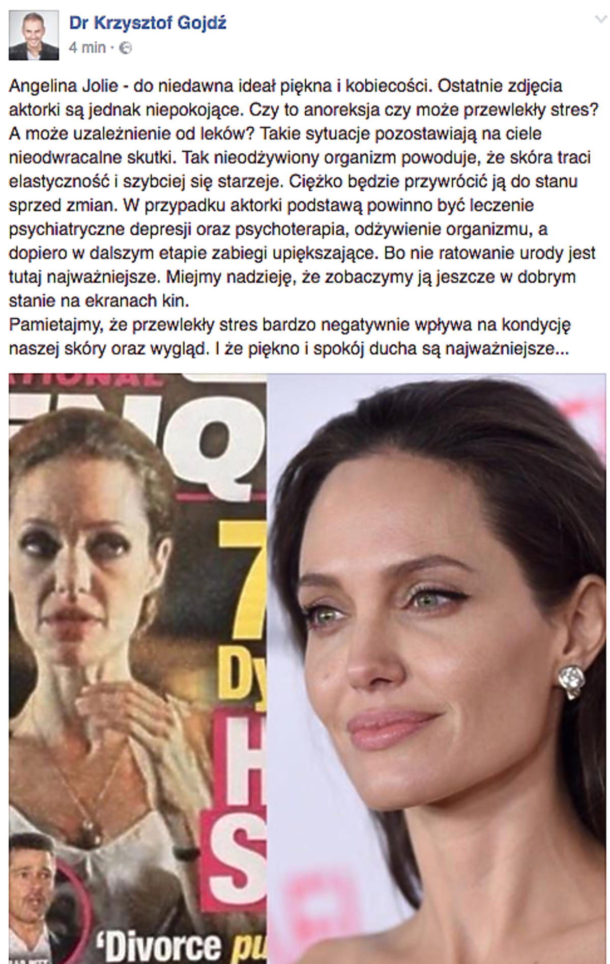 Krzysztof Gojdź o Angelinie Jolie