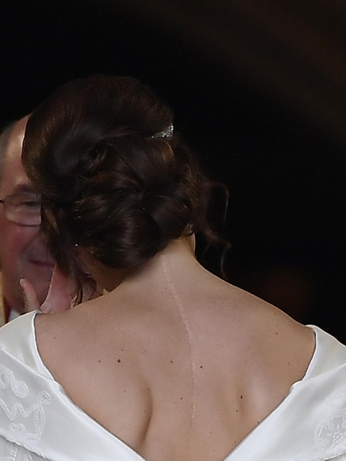 Księżniczka Eugenia pokazała ogromną bliznę na plecach podczas ślubu