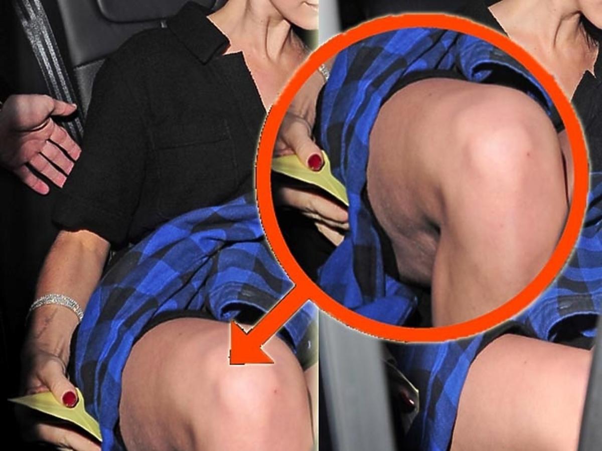 Lana Del Rey cellulit