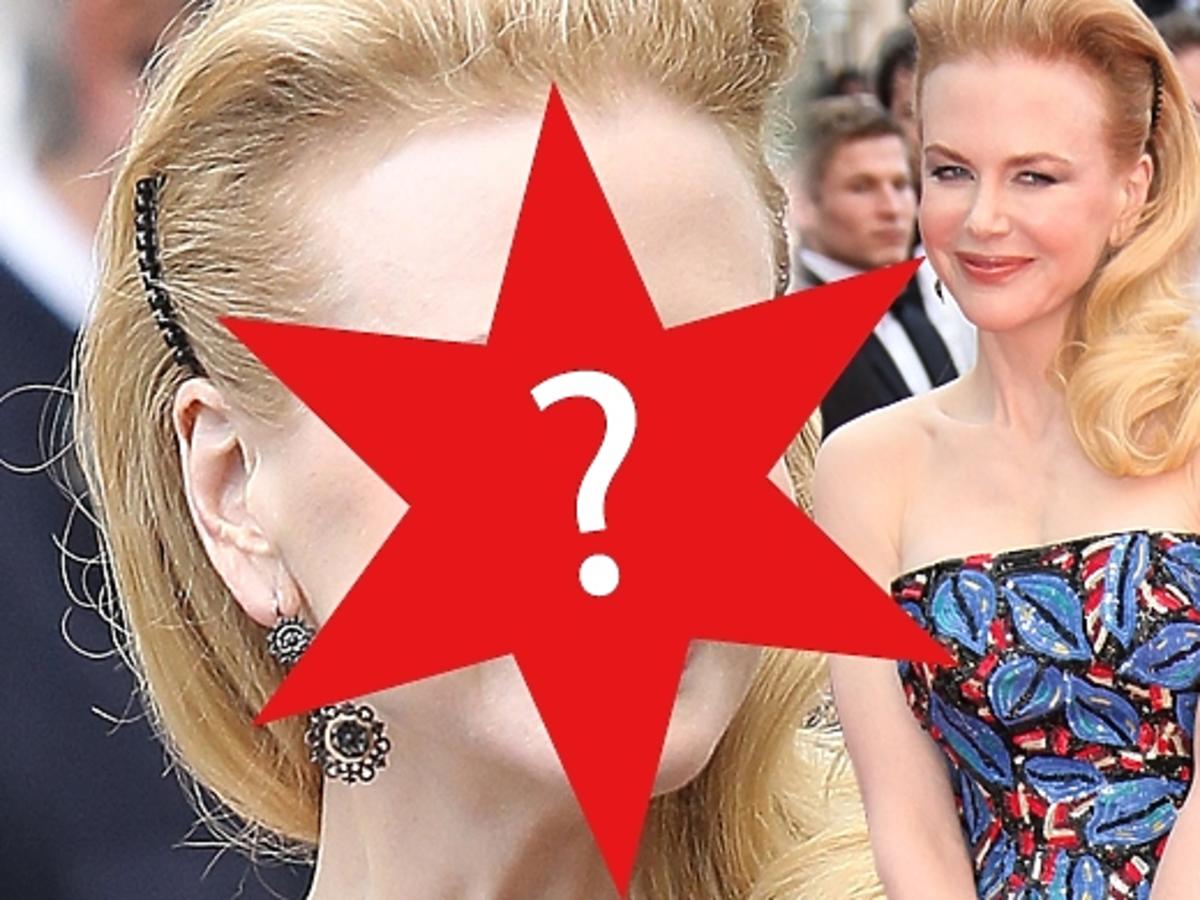 Nicole Kidman przesadziła z botoksem