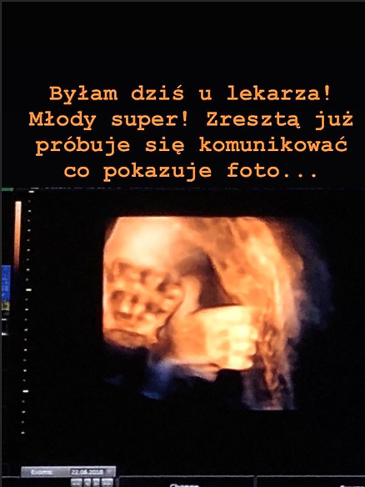 Odeta Moro pokazała zdjęcia synka