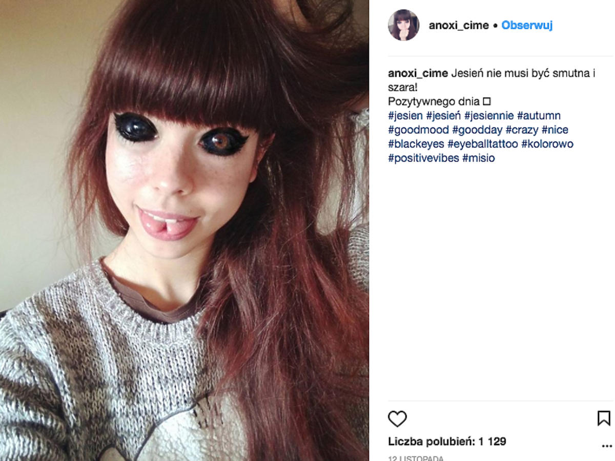 Ola Sadowska traci wzrok po wytatuowaniu gałek ocznych