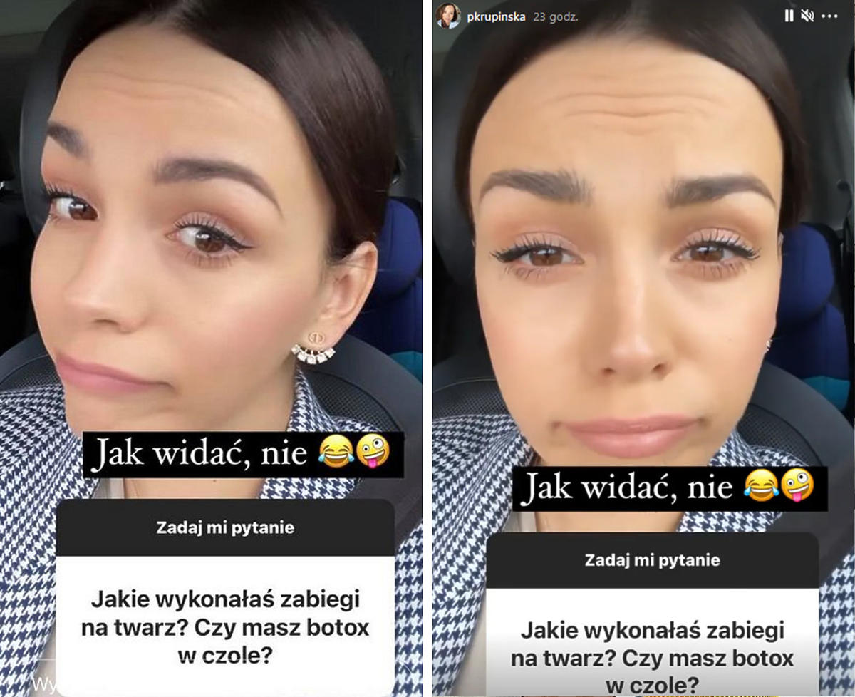 Paulina Krupińska poprawiała urodę i wstrzyknęła sobie botoks?! Gwiazda TVN zdradziła prawdę