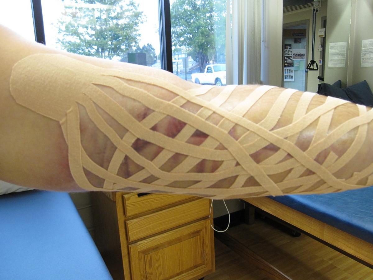 Plastry kinesio na urazy