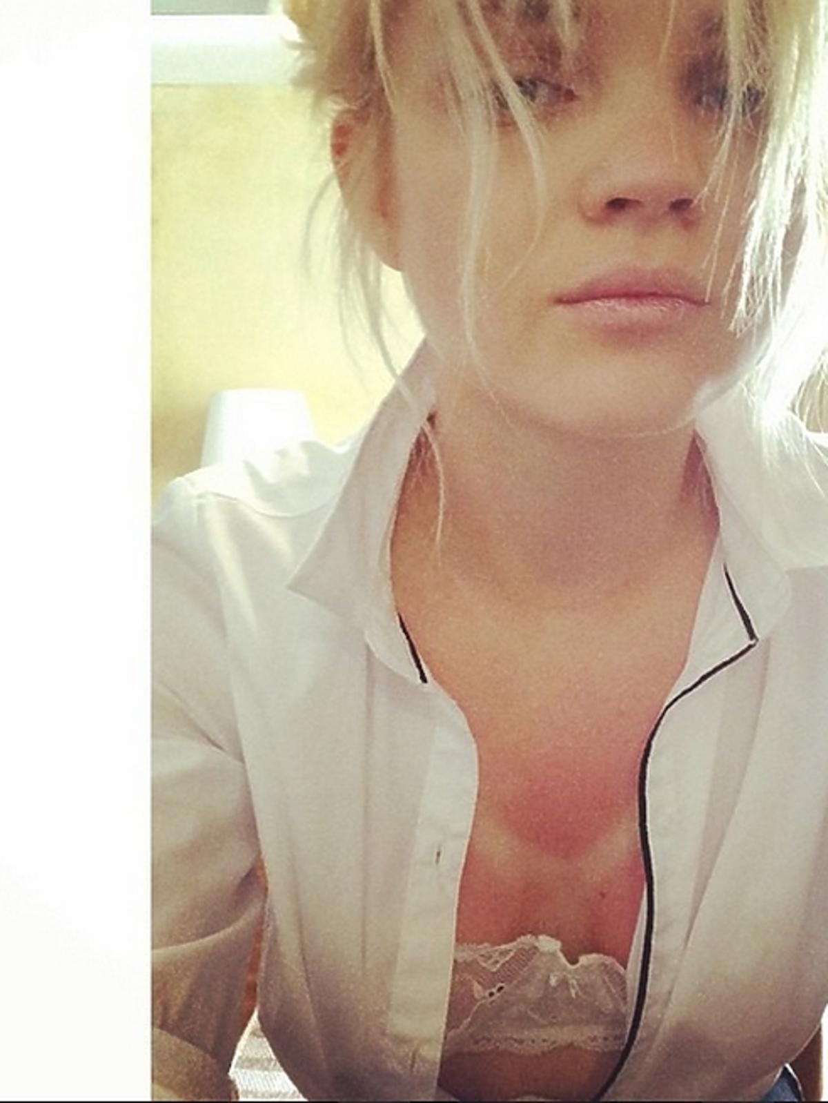Poparzone piersi Margaret na Instagramie