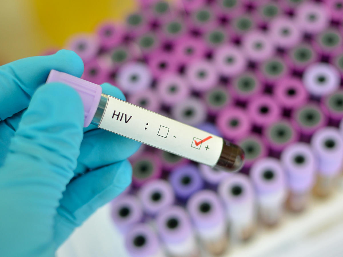 Próbka krwi - test na HIV