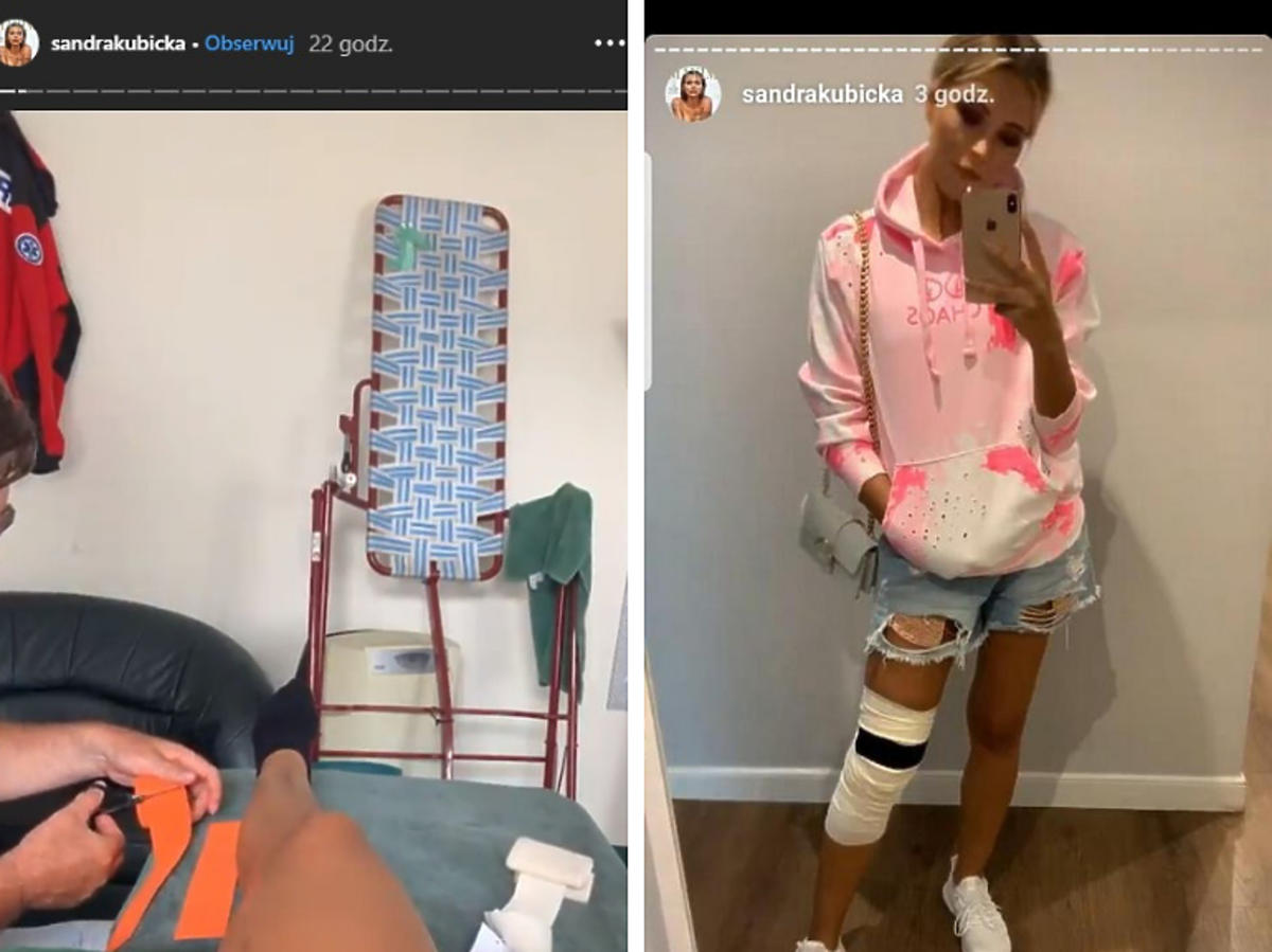 Sandra Kubicka po kontuzji nosi stabilizator
